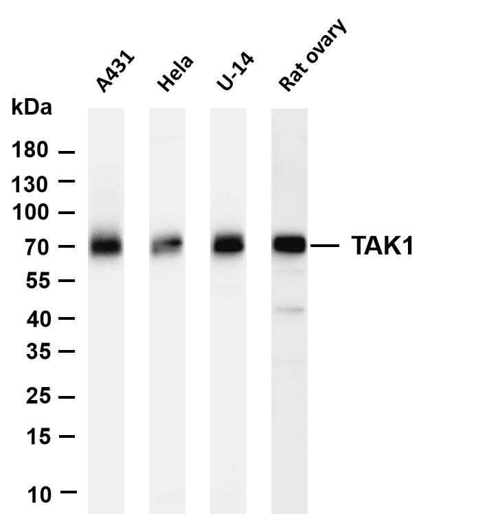 Various whole cell lysates were separated by 4-20% SDS-PAGE, and the membrane was blotted with anti-TAK1 antibody. The HRP-conjugated Goat anti-Rabbit IgG (H+L) antibody was used to detect the antibody.