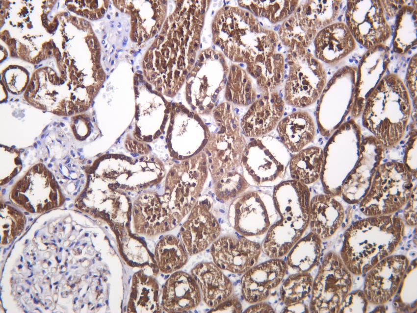Human kidney was stained with anti-GLUT-2 Rabbit antibody.
