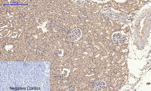 Immunohistochemical analysis of paraffin-embedded Rat-kidney tissue. 1,Glut4 Polyclonal Antibody was diluted at 1:200（4°C,overnight）. 2, Sodium citrate pH 6.0 was used for antibody retrieval（>98°C,20min）. 3,Secondary antibody was diluted at 1:200（room tempeRature, 30min）. Negative control was used by secondary antibody only.