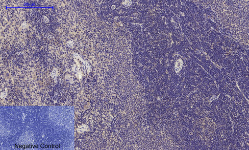 Immunohistochemical analysis of paraffin-embedded Rat-spleen tissue. 1,Glut4 Polyclonal Antibody was diluted at 1:200（4°C,overnight）. 2, Sodium citrate pH 6.0 was used for antibody retrieval（>98°C,20min）. 3,Secondary antibody was diluted at 1:200（room tempeRature, 30min）. Negative control was used by secondary antibody only.