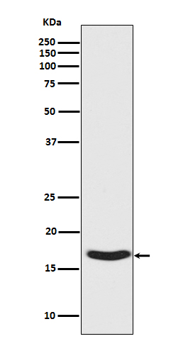 Western blot analysis of Synuclein phosphorylation expression in Human fetal brain lysate.