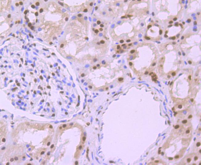 Immunohistochemical analysis of paraffin-embedded human kidney tissue using anti-Phospho-alpha Synuclein (S129) antibody. The section was pretreated using heat mediated antigen retrieval with Tris-EDTA buffer (pH 9.0) for 20 minutes. The tissues were blocked in 1% BSA for 30 minutes at room temperature, washed with ddH2O and PBS, and then probed with the primary antibody for 30 minutes at room temperature.
