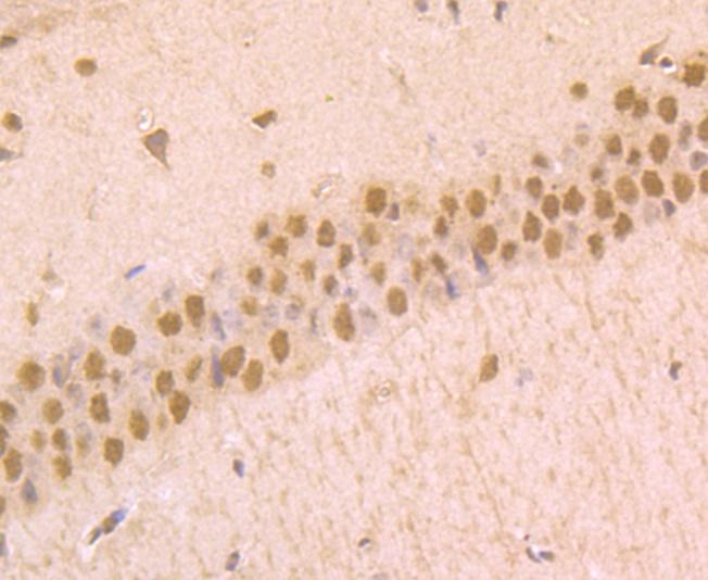 Immunohistochemical analysis of paraffin-embedded mouse brain tissue using anti-Phospho-alpha Synuclein (S129) antibody. The section was pretreated using heat mediated antigen retrieval with Tris-EDTA buffer (pH 9.0) for 20 minutes.The tissues were blocked in 1% BSA for 30 minutes at room temperature, washed with ddH2O and PBS, and then probed with the primary antibody(1/50) for 30 minutes at room temperature.