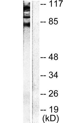 Western blot analysis of lysates from NIH/3T3 cells, using Cadherin Antibody.The lane of the right is blocked with the synthesized peptide.