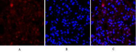 Immunofluorescence analysis of rat-lung tissue. 1,E-cadherin Polyclonal Antibody（red） was diluted at 1:200（4°C,overnight）. 2, Cy3 labled Secondary antibody was diluted at 1:300（room temperature, 50min）.3, Picture B: DAPI（blue） 10min. Picture A:Target. Picture B: DAPI. Picture C: mergeofA+B