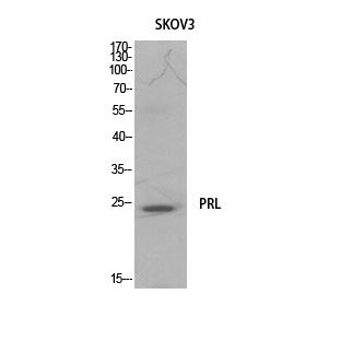 Western Blot analysis of SKOV3 cells using Prolactin Polyclonal Antibody. Secondaryantibodywasdilutedat1:20000
