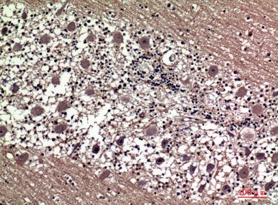 Immunohistochemical analysis of paraffin-embedded human-brain, antibody wasdilutedat1:100