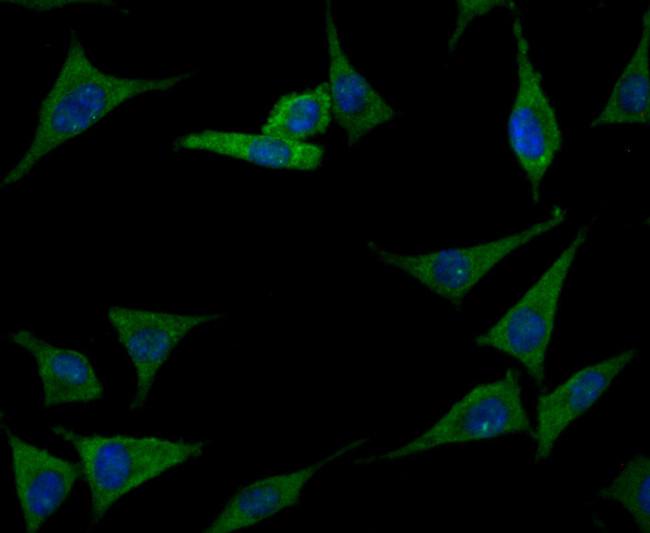 Immunocytochemistry-ImmunofluorescenceanalysisofProlactin/PRLinSH-SY-5Ycells (green).