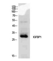 Western Blot analysis of MCF7 cells using IGFBP1 Polyclonal Antibody.