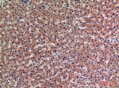 Immunohistochemical analysis of paraffin-embedded human-liver, antibody wasdilutedat1:100
