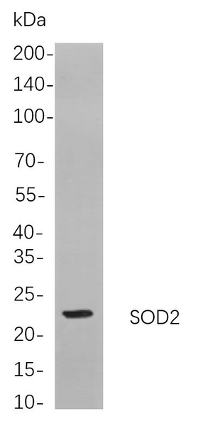 Western blot analysis of lysates from Hela cells, using SOD2 Rabbit mAb. The HRP-conjugated Goat anti-Rabbit IgG antibody was used to detect the antibody.