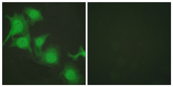 Immunofluorescence analysis of HUVEC cells, using Nrf2 Antibody. The picture on the right is blocked with the synthesized peptide.