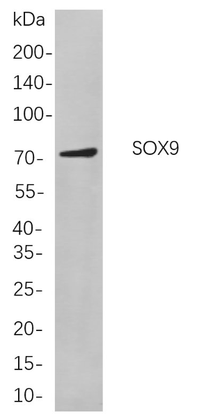 Western blot analysis of lysates from HepG2 cells, using SOX9 Rabbit mAb. The HRP-conjugated Goat anti-Rabbit IgG antibody was used to detect the antibody.