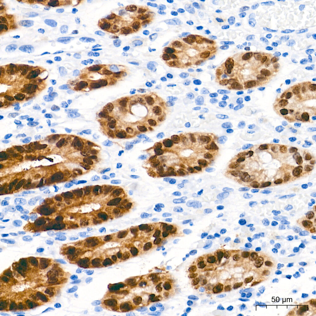 Immunohistochemistry analysis of paraffin-embedded Human colon tissue using SOX9 Rabbit mAb at a dilution of 1:1000 (40x lens). High pressure antigen retrieval performed with 0.01M Tris-EDTA Buffer (pH 9.0) prior to IHC staining.