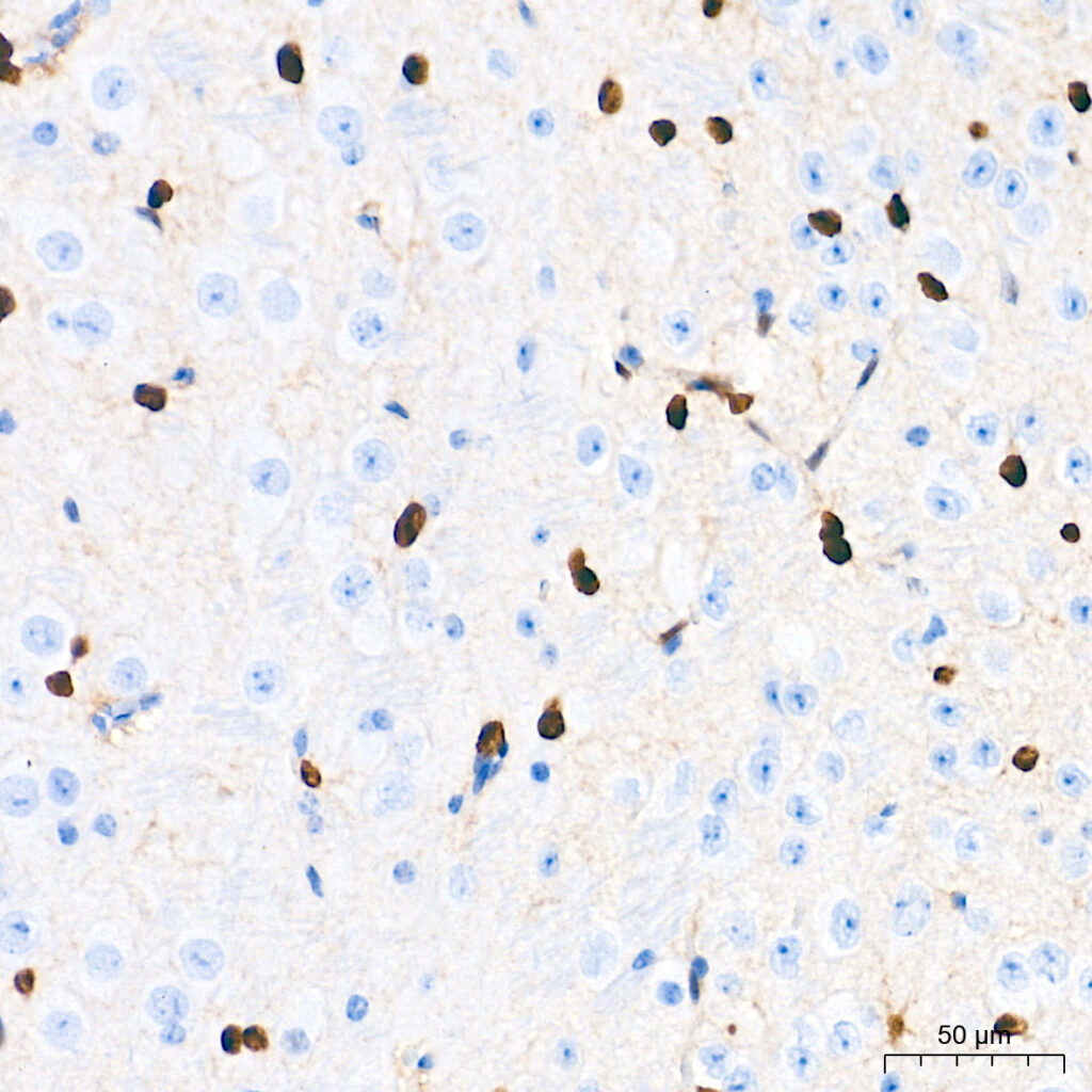 Immunohistochemistry analysis of paraffin-embedded Mouse brain tissue using SOX9 Rabbit mAb at a dilution of 1:1000 (40xlens). High pressure antigen retrieval performed with 0.01M Tris-EDTA Buffer (pH 9.0) prior to IHC staining.