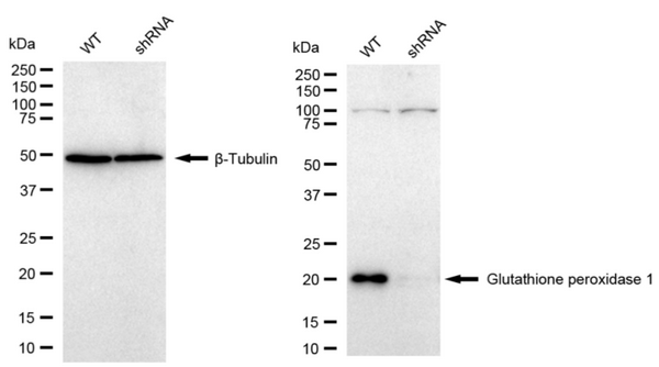 Western blotting analysis using Glutathione peroxidase 1 antibody. Glutathione peroxidase 1 expression in wild type (WT) and Glutathione peroxidase 1 shRNA knockdown (KD) HeLa cells with 30 μg of total cell lysates. β-Tubulin serves as a loading control. The blot was incubated with Glutathione peroxidase 1 antibody ( 1:5,000) and HRP-conjugated goat anti-rabbit secondary antibody (1:10,000) respectively.