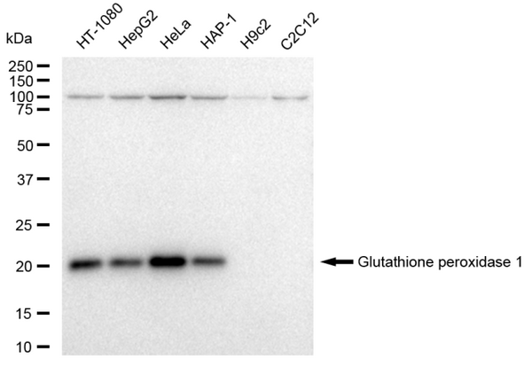 Western blotting analysis using Glutathione peroxidase 1 antibody. Total cell lysates (30 μg) from various cell lines were loaded and separated by SDS-PAGE. The blot was incubated with Glutathione peroxidase 1 antibody (1:5,000) and HRP-conjugated goat anti-rabbit secondary antibody (1:10,000) respectively.