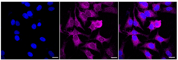 Immunocytochemical staining of Hela cells with Glutathione peroxidase 1 antibody (1:1,000). Nuclei were stained blue with DAPI; Glutathione peroxidase 1 was stained magenta with Alexa Fluor® 647. Images were taken using Leica stellaris 5. Protein abundance based on laser Intensity and smart gain: Low. Scale bar: 20 μm.
