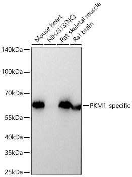 Western blot analysis of various lysates using PKM1-specific Rabbit mAb at 1:9000 dilution incubated overnight at 4℃.
