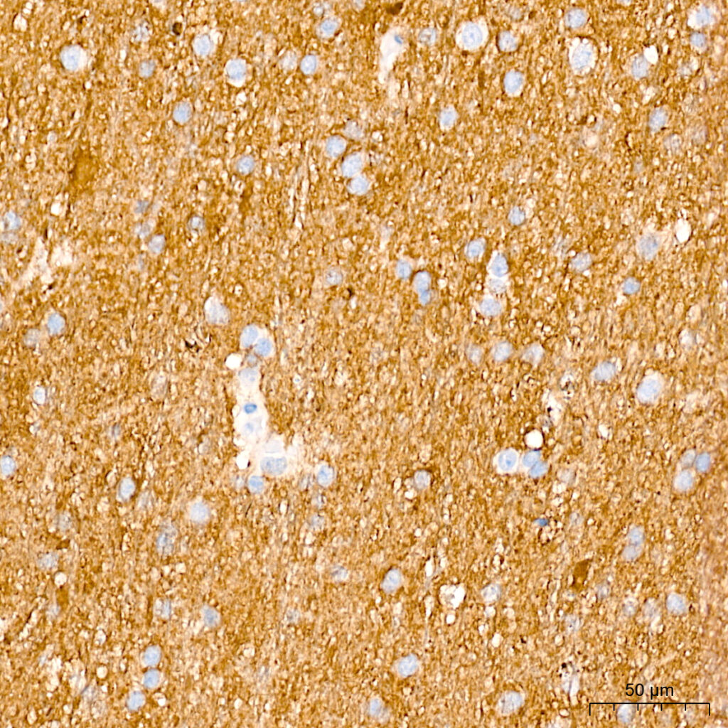 Immunohistochemistry analysis of paraffin-embedded Human brain tissue using PKM1-specific Rabbit mAb at a dilution of 1:5000 (40x lens). High pressure antigen retrieval performed with 0.01M Tris-EDTA Buffer (pH 9.0) prior to IHC staining.