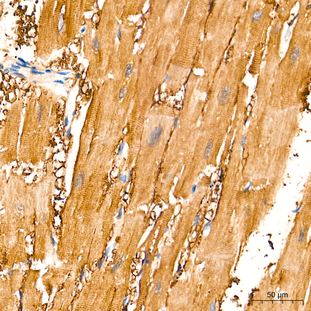 Immunohistochemistry analysis of paraffin-embedded Human heart tissue using PKM1-specific Rabbit mAb at a dilution of 1:5000 (40x lens). High pressure antigen retrieval performed with 0.01M Tris-EDTA Buffer (pH 9.0) prior to IHC staining.