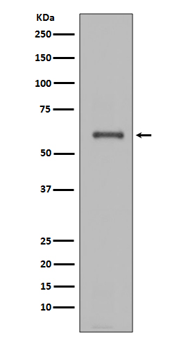 Western blot analysis of NOX4 expression in JAR cell lysate. Please find below information for reference. Working dilution of the primary antibody 1: 1000 Working dilution of the Secondary antibody: 1: 8000 Samples of the experiments: Sample loading volume 25ul Chemiluminescent substrate: ECL West Pico Plus Notes for Western Blot: Add protease inhibitors during sample processing and lyse samples with dedicated membrane protein lysis buffer. Do not boil the samples at high temperature; All subsequent procedures following standard WB protocols would be fine.