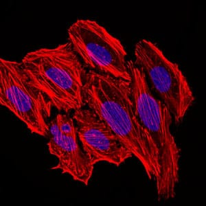 Immunofluorescence analysis of HepG2 cells. Blue: DRAQ5 fluorescent DNA dye. Red: Actin filaments have been labeled with Alexa Fluor-555 phalloidin.