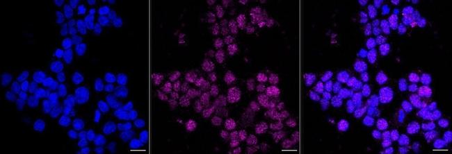 Immunocytochemistry analysis of PDX1 in HeLa cells. Sample was incubated with PDX1 monoclonal antibody at a dilution of 1:1,000, followed by DAPI and Alexa Fluor 647. Protein abundance based on laser intensity and smart gain: Medium. Scale bar, 20μm.