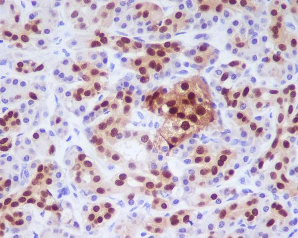 Immunohistochemical (Paraffin) analysis of PDX1 in Human pancreas using PDX1 Recombinant Monoclonal Antibody. High-pressure and temperature Sodium Citrate pH 6.0 was used for antigen retrieval.