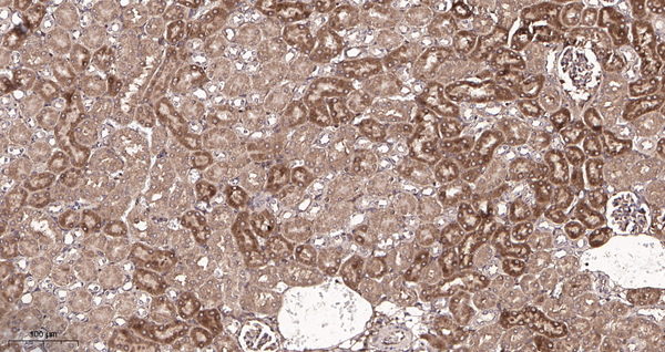Immunohistochemical analysis of paraffin-embedded Mouse kidney tissue. 1, Beclin 1 Rabbit Monoclonal Antibody was diluted at 1:200(4°C,overnight). 2, EDTA pH 9.0 was used for antibody retrieval(>98°C,20min). 3,Secondary antibody was diluted at 1:200(room temperature, 30min).
