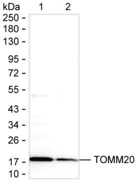 Western blot analysis using TOMM20 mouse mAb against mouse brain and rat brain
