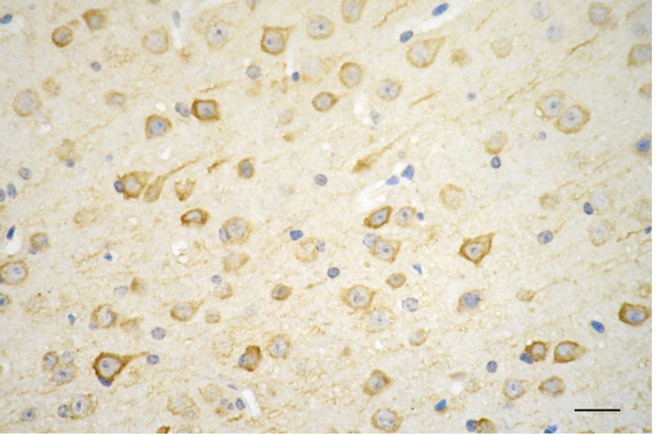 Immunohistochemistry was performed on paraffin-embedded mouse brain using LC3A/LC3B antibody (1:200). Antigen retrieval was done in sodium citrate buffer (pH 6.0). DAB was used for detection, with hematoxylin counterstaining. Images were acquired using a Nikon Ci-L Plus microscope (40× objective). Scale bar: 25 μm.