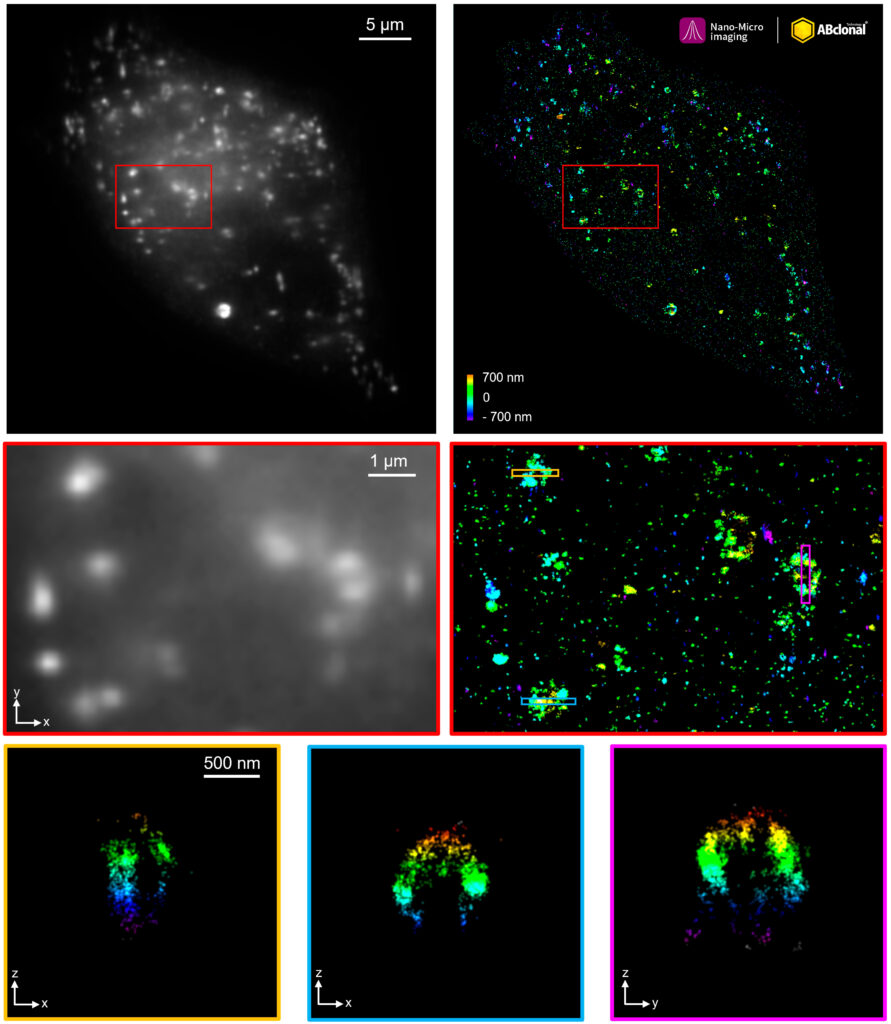 The STORM super-resolution (SR) imaging of HeLa cells using SQSTM1/p62 Rabbit mAb at dilution of 1:200 with 3% paraformaldehyde (PFA) +0.1% glutaraldehyde (GA) fixation. The immunostaining was performed by Full Automatic Immunofluorescence Workflow System (Workflow Ultra300, Nano-Micro imaging, China). Image was performed with Single-Molecule Localization Super-Resolution Microscopy (STORM Ultra300, Nano-Micro imaging.