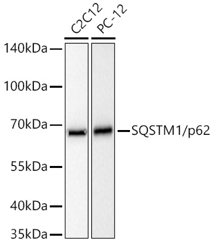 Western blot analysis of various lysates using SQSTM1/p62 Rabbit mAb at 1:20000 dilution incubated overnight at 4℃. Secondary antibody: HRP-conjugated Goat anti-Rabbit IgG (H+L) at 1:10000 dilution. Lysates/proteins: 25 μg per lane. Blocking buffer: 3% nonfat dry milk in TBST. Detection: ECL West Pico Plus. Exposure time: 10s.