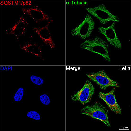 Confocal imaging of HeLa cells using SQSTM1/p62 Rabbit mAb (dilution 1:200) followed by a further incubation with Cy3 Goat Anti-Rabbit IgG (H+L) ( dilution 1:500) (Red). The cells were counterstained with α-Tubulin Mouse mAb ( dilution 1:400) followed by incubation with conjugated Goat Anti-Mouse IgG (H+L) Ab ( dilution 1:500) (Green). DAPI was used for nuclear staining (Blue). Objective: 100x.