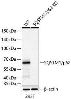 Western blot analysis of lysates from wild type (WT) and SQSTM1/p62 knockout (KO) 293T cells using [KO Validated] SQSTM1/p62 Rabbit mAb at 1:20000 dilution incubated overnight at 4℃.