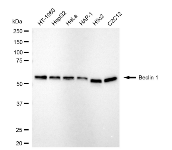 Western blotting analysis using beclin 1 antibody. Total cell lysates (30 μg) from various cell lines were loaded and separated by SDS-PAGE. The blot was incubated with beclin 1 antibody (1:5,000) and HRP-conjugated goat anti-rabbit secondary antibody (1:10,000) respectively.