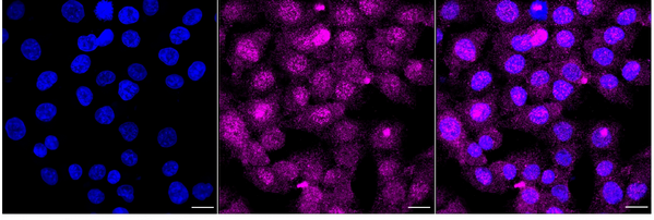 Immunocytochemical staining of HT-1080 cells with Beclin 1 antibody (1:1,000). Nuclei were stained blue with DAPI; Beclin 1 was stained magenta with Alexa Fluor 647. Images were taken using Leica stellaris 5. Protein abundance based on laser Intensity and smart gain: Medium. Scale bar, 20 μm.