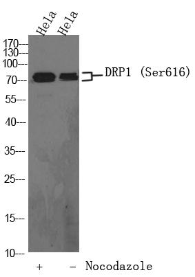 Western Blot analysis of hela cells, hela cell treated or untreated by Nocodazole at 100 ng/ml 17h. Primary Antibody was diluted at 1:1000. Secondaryantibodywasdilutedat1:10000