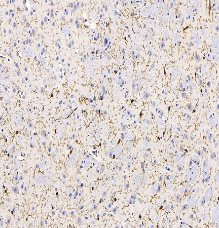 IHC analysis of Iba1. Sample: Mouse brain, 4% PFA 12-24h. Antigen retrieval: Citrate buffer (pH 6.0), 98℃, 20 min. Primary antibody: 1: 2000, 4℃ overnight. Secondary antibody: HRP conjugated Goat Anti-Mouse lgG (H+L) 1: 200, RT, 1h.
