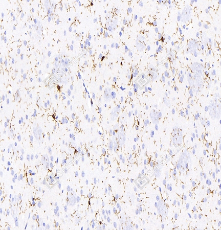 IHC analysis of Iba1. Sample: Rat brain, 4% PFA 12-24h. Antigen retrieval: Citrate buffer (pH 6.0) 98℃, 20 min. Primary antibody: 1: 2000, 4℃ overnight. Secondary antibody: HRP conjugated Goat Anti-Mouse lgG (H+L) 1: 200, RT, 1h.