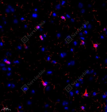 IF analysis ofIba1 red. Sample: Rat brain, 4% PFA12-24h. Antigen retrieval: Tris-EDTA buffer (pH 9.0), 98℃, 20min. Blocking buffer: 3% BSA in PBS, RT, 30min. Primary antibody: 1: 1000, 4℃ overnight. Secondary antibody: Cy3 conjugated Goat Anti-Mouse IgG (H+L), 1: 300, RT, 1h.