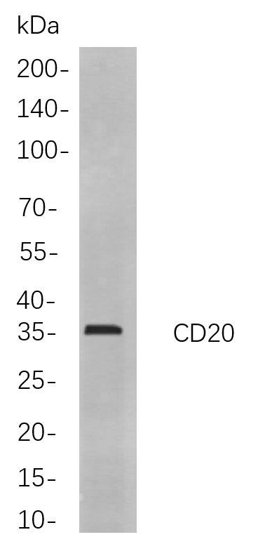 Western blot analysis of lysates from Raji cells, using CD20 Rabbit mAb. The HRP-conjugated Goat anti-Rabbit IgG antibody was used to detect the antibody.