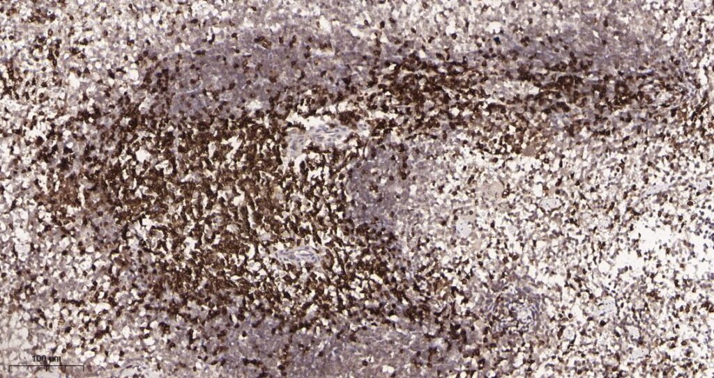 Immunohistochemical analysis of paraffin-embedded Mouse spleen tissue. 1, CD3 Rabbit Monoclonal Antibody was diluted at 1:200(4°C,overnight). 2, EDTA pH 9.0 was used for antibody retrieval(>98°C,20min). 3,Secondary antibody was diluted at 1:200(room temperature,30min).