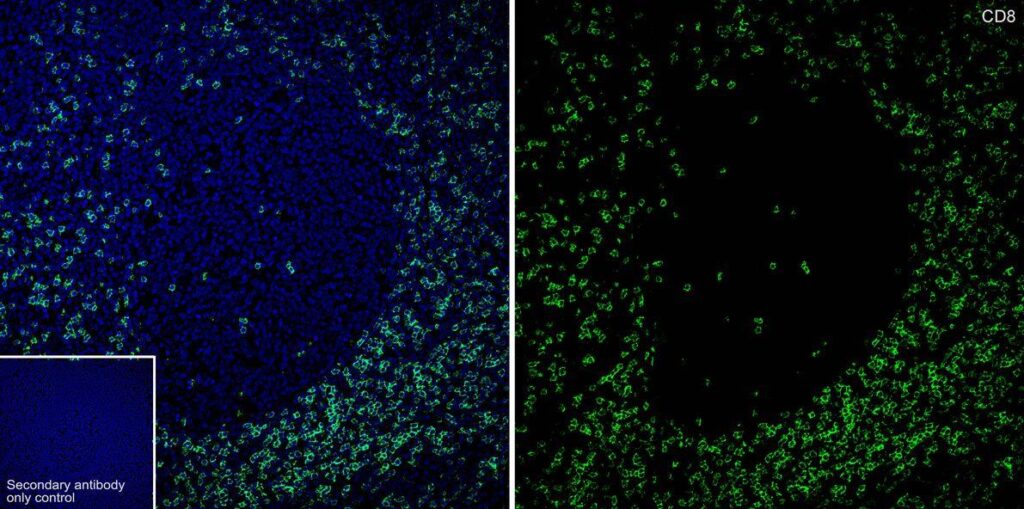 Species:HumanSite:tonsil;Sample: Paraffin-embedded section; Antibody concentration: 1/1,000