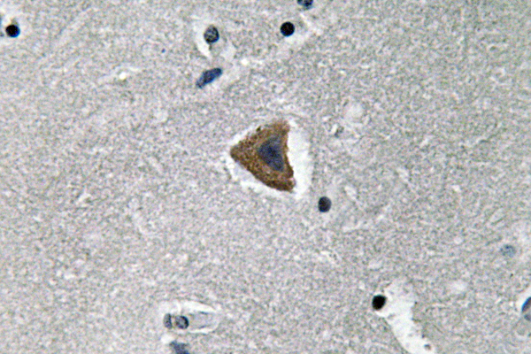 Immunohistochemistry analysis of Rock-1 antibody in paraffin-embedded human brain tissue.