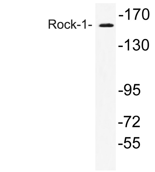 Western blot analysis of lysate from COS7 cell, using Rock-1 antibodys.