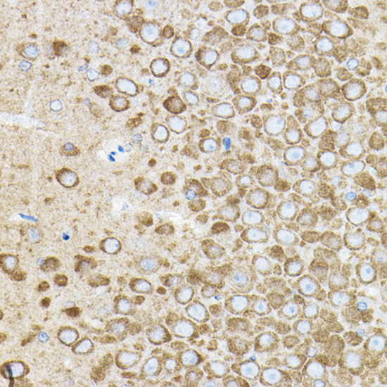 Immunohistochemistry analysis of paraffin-embedded Rat brain using ROCK2 Rabbit pAb at dilution of 1:50 (40x lens). High pressure antigen retrieval performedwith 0.01M Citrate buffer (pH 6.0) prior to IHC staining.